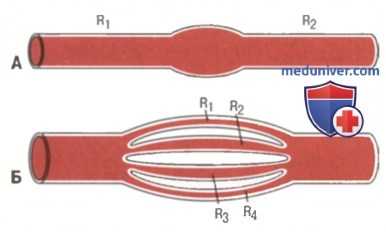 Закон Пуазейля. Диаметр артериол и их сопротивление