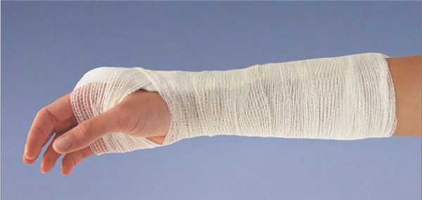 лангета на запястье