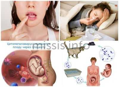 Инфекции на раннем сроке беременности