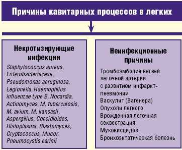 Рис. 2. Причины кавитарных процессов в легких