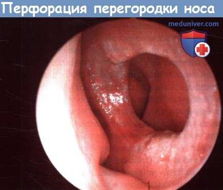 Пульмонология