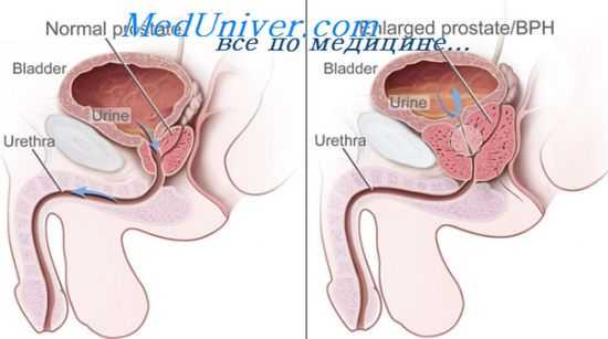 оценка кровоснабжения