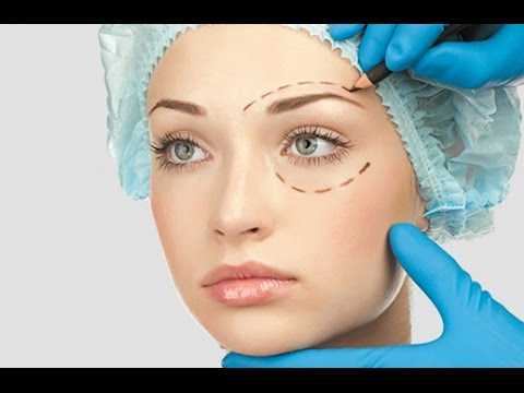 Видео Выворот века и его лечение