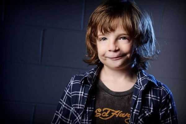 Ребёнок с синдромом Гольденхара