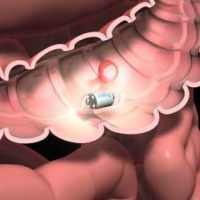 Гепатобилисцинциграфия