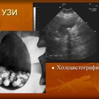 Диагностика желчевыводящих путей