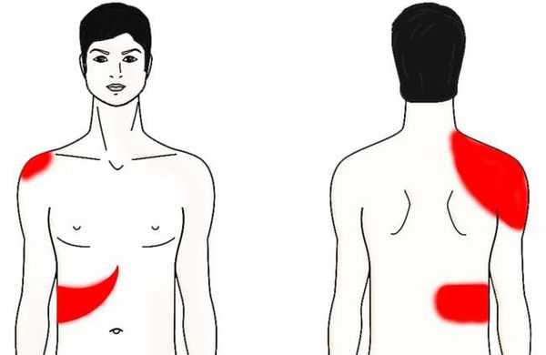 Болевые зоны при хроническом холецистите