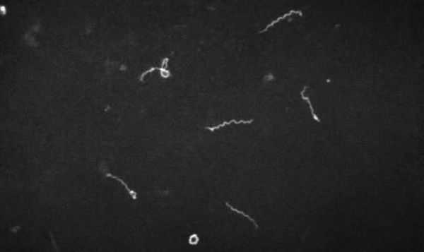 Микроскопия в тёмном поле