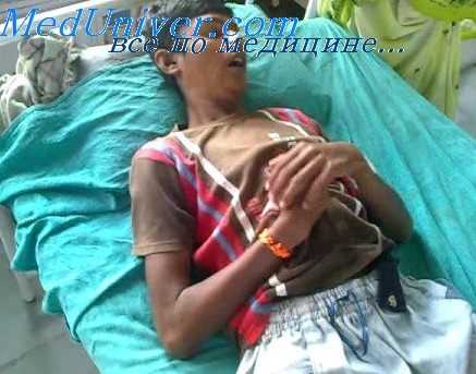 болезни печени