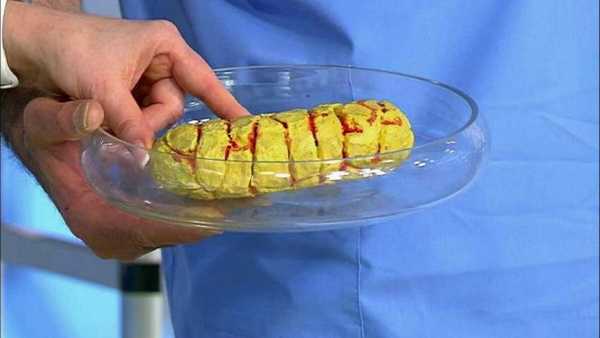 Слизь в кале — что означает стул со слизью