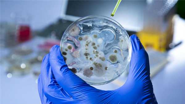 Повышенное содержание слизи в стуле