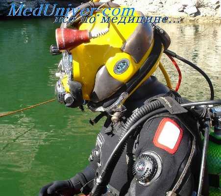 декомпрессионная болезнь