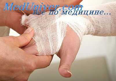 жировая эмболия