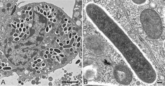 Форма риккетсий.
