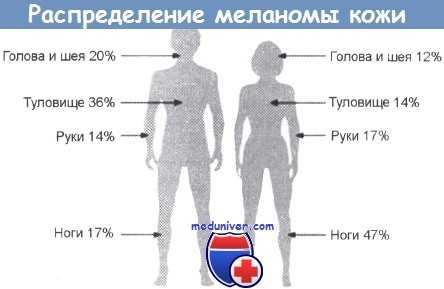 Распределение меланомы кожи