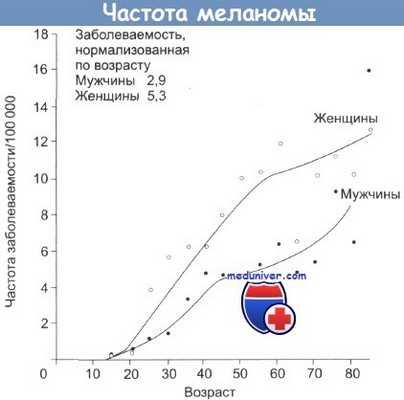 Частота меланомы