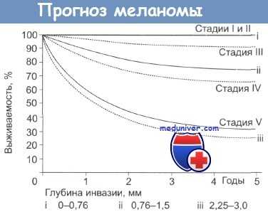 Прогноз меланомы