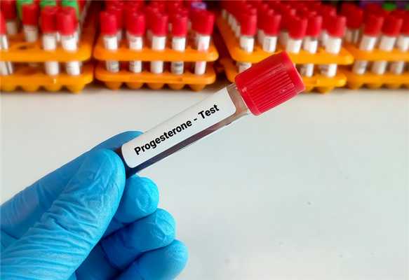 Когда проводится исследование уровня прогестерона?