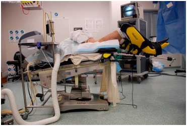 Операция выполняется в положении пациента на спине или нижней литотомической позиции (на спине, с ногами, установленными на специальные подставки).