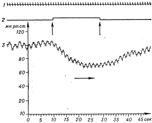 Рис. 1. Кимограмма — запись артериального давления кролика при раздражении депрессорного нерва: 1— отметка времени (1 сек.); 2— отметка раздражения (стрелками показано начало и окончание раздражения); 3 — запись изменения уровня артериального давления (по оси ординат — уровень артериального давления в мм рт. ст., по оси абсцисс — время); ось абсцисс — нулевая линия, стрелкой показано направление движения записи.