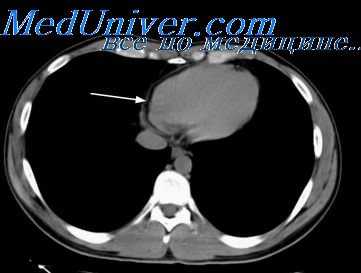 рентгеноэлектрокимография