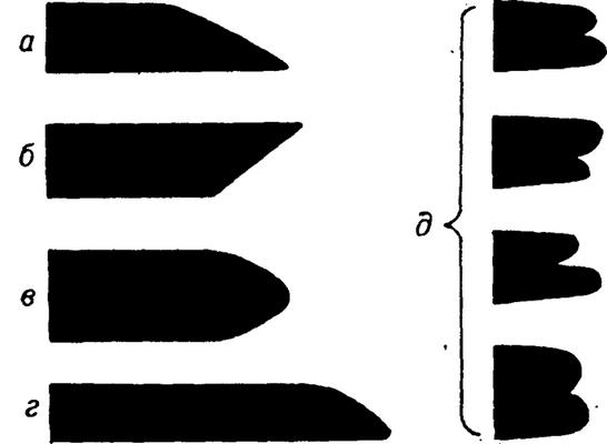 Рис. 3. Типичная форма рентгенокимо-графических зубцов сердца и магистральных сосудов: а — желудочковый зубец; б — зубец магистрального сосуда; в — желудочковый зубец при брадикардии; г — желудочковый зубец при тахикардии; д — варианты предсердных зубцов.