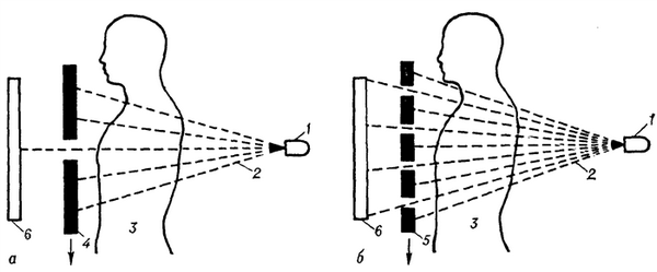 Рис. 1. Принципиальная схема рентгенокимографии: а — однощелевая рентгенокимография; б — многощелевая рентгенокимографии; 1 — источник рентгеновского излучения; 2 — пучок рентгеновского излучения; 3 — тело пациента; 4 — однощелевая свинцовая пластина; 5 — многощелевая свинцовая пластина (кимографическая решетка); 6 — кассета с рентгеновской пленкой; стрелкой указано направление движения свинцовой пластины (при горизонтальном расположении щелей).