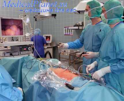 Торакоскопия