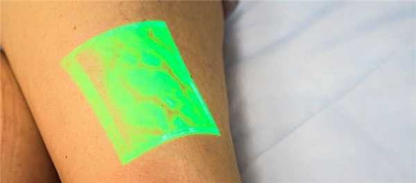 Трансиллюминация