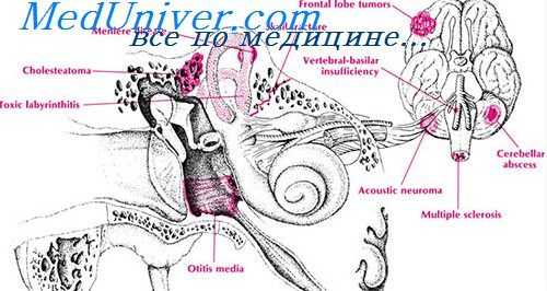 гальванический нистагм