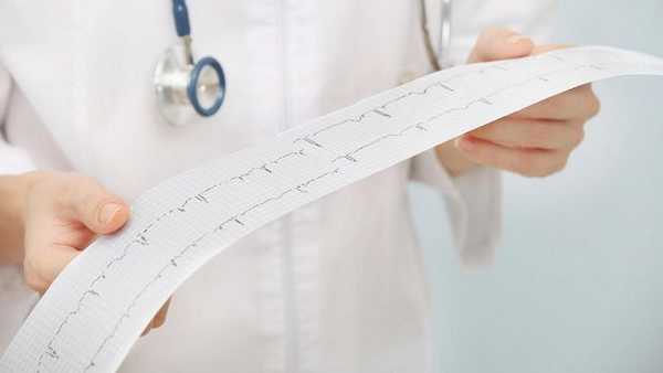 Электрокардиограмма