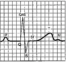 Рисунок 2. Нормальный ЭКГ-комплекс