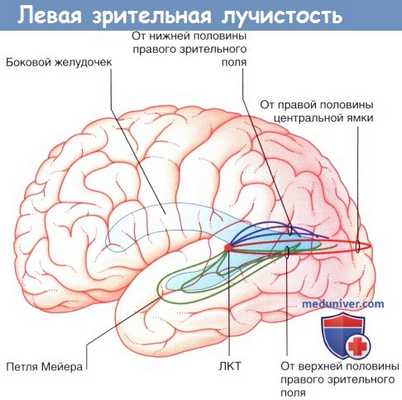 Левая зрительная лучистость