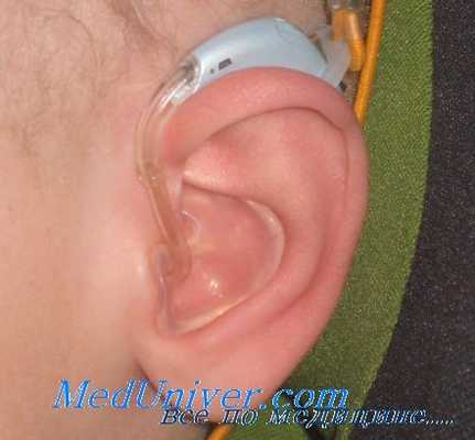 зрительное восприятие у глухих