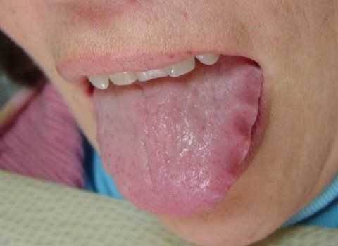 Зубчатый язык