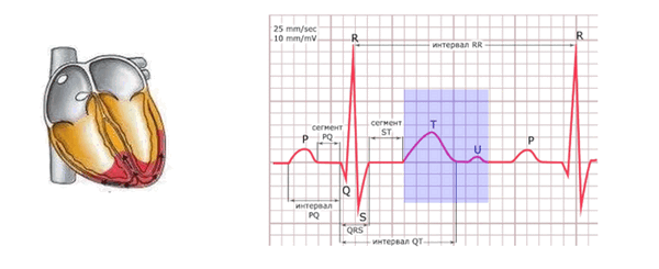Схема формирования зубцов T и U на ЭКГ.