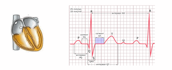 Схема формирования сегмента ST на ЭКГ.