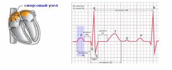 Схема формирования зубца P на ЭКГ.