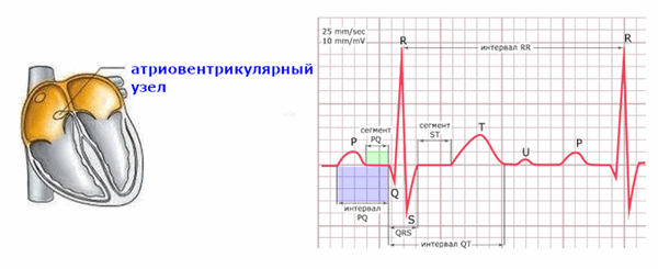 Схема интервал и сегмент PQ на ЭКГ.