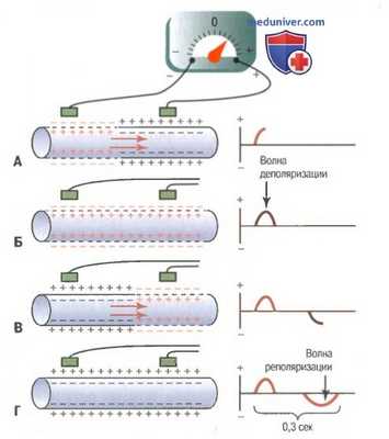 Нормальная электрокардиограмма