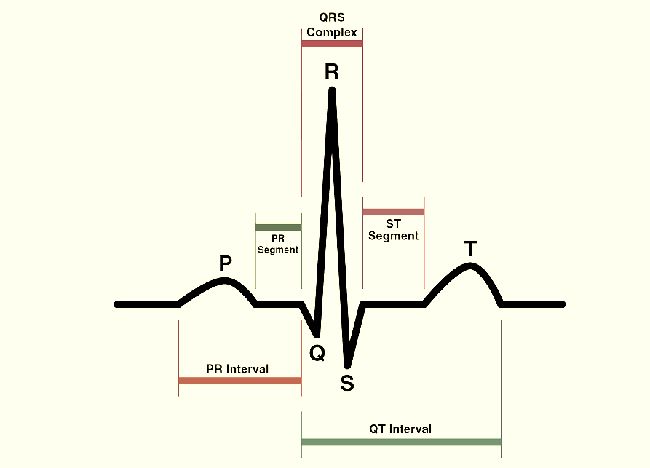 Зубцы на кардиограмме