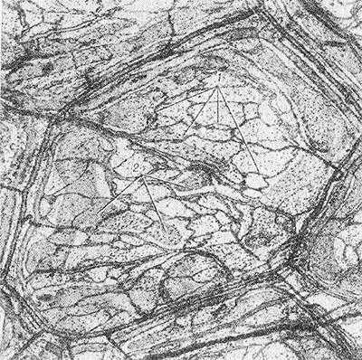 Рис. 1. Микроциркуляторное русло фиброзной капсулы почки: кровеносные (1) и лимфатические (2) капилляры. Микроскопический препарат, импрегнированный азотистокислым серебром; X 120.